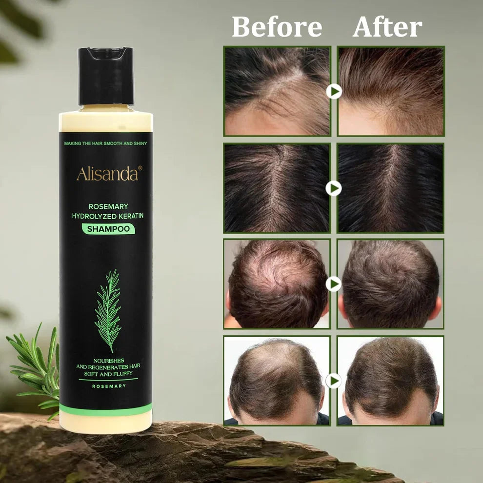 🔥LAST DAY 50% OFF - 🎅Alisanda® Organic Rosemary Hair Growth Shampoo