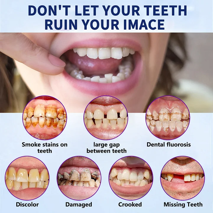 NESLEMY-🦷Advanced Customized Full Denture Set🦷