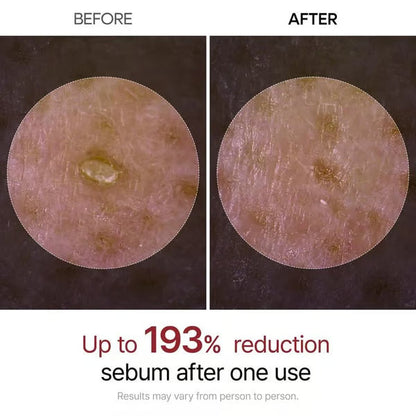 🏆Flash Sale⚡ 50K+ SOLD! Almost Gone-💥🔥Peel Shot Glow Rice Ampoule Duo